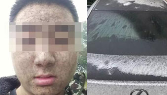 膜結(jié)構(gòu)車棚讓你遠離“黑雨”